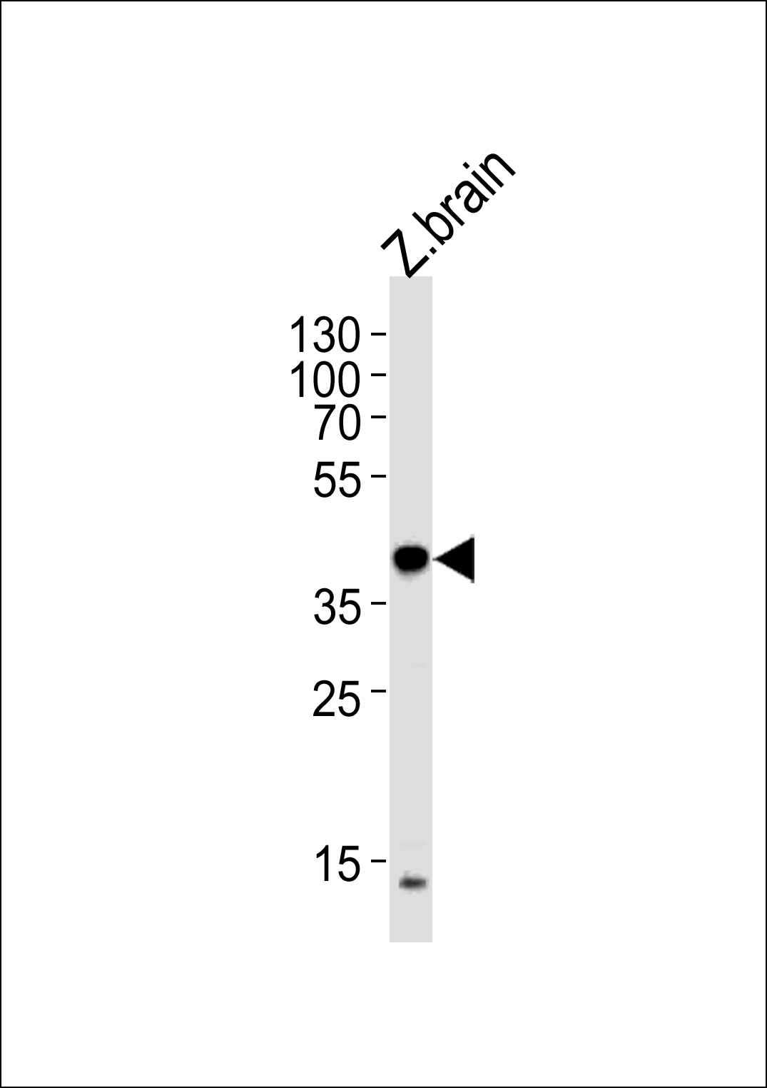 Rabbit Polyclonal Antibody to EIF3E(Center)