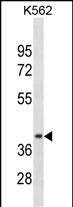 Rabbit Polyclonal Antibody to CCNDBP1(N-term)