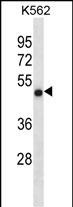 Rabbit Polyclonal Antibody to CCDC6(N-term)