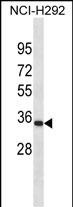 Rabbit Polyclonal Antibody to PRRX1(C-term)