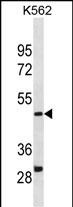Rabbit Polyclonal Antibody to DHODH(Center)