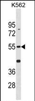 Rabbit Polyclonal Antibody to Mouse Cdk14(N-term)