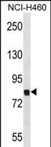 Rabbit Polyclonal Antibody to Mouse Dyrk1a(C-term)