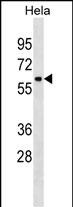 Rabbit Polyclonal Antibody to ZNF410(C-term)
