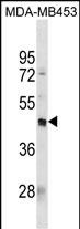 Rabbit Polyclonal Antibody to PDCD2L(Center)