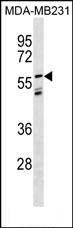 Rabbit Polyclonal Antibody to LGI3(Center)