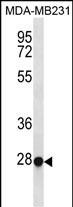 Rabbit Polyclonal Antibody to TFEC(Center)