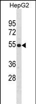 Rabbit Polyclonal Antibody to ZNF101(Center)