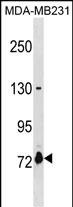 Rabbit Polyclonal Antibody to ASNSD1(Center)