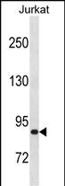 Rabbit Polyclonal Antibody to ZNF337(C-term)