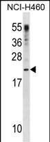 Rabbit Polyclonal Antibody to CSF3(C-term)