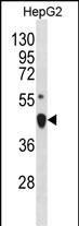Rabbit Polyclonal Antibody to LHX4(Center)