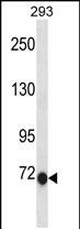 Rabbit Polyclonal Antibody to CLIC6(C-term)