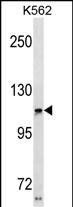 Rabbit Polyclonal Antibody to USH1C(N-term)
