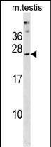 Rabbit Polyclonal Antibody to PHOSPHO2(N-term)
