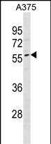 Rabbit Polyclonal Antibody to DPCR1(Center)