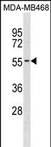 Rabbit Polyclonal Antibody to KCNK6(C-term)