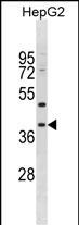Rabbit Polyclonal Antibody to MPPED1(Center)