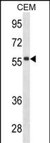 Mouse Monoclonal Antibody to IGHD (N-term)