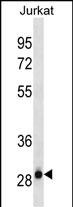 Mouse Monoclonal Antibody to HAGH