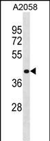 Rabbit Polyclonal Antibody to RNF149(Center)