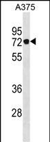 Rabbit Polyclonal Antibody to PODN(C-term)