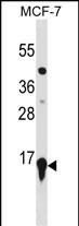 Rabbit Polyclonal Antibody to HIST2H3A(C-term)