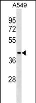Rabbit Polyclonal Antibody to DPEP1(N-term)