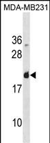 Rabbit Polyclonal Antibody to LGALS7(Center)