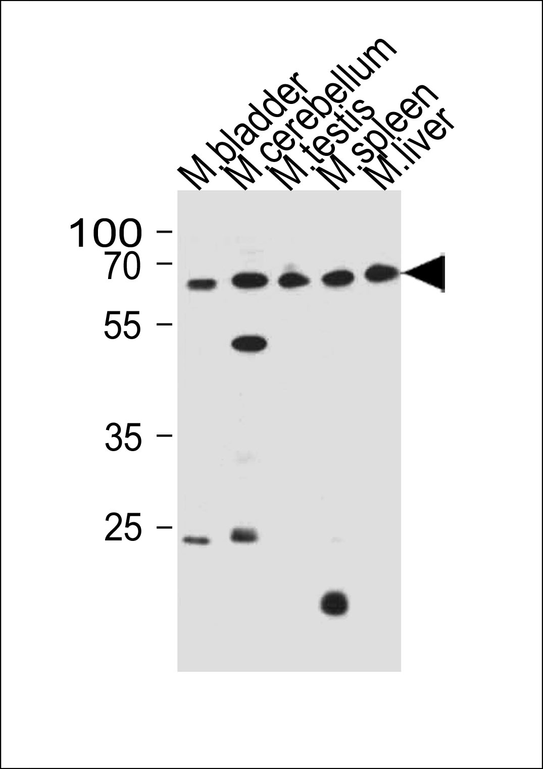 Rabbit Polyclonal Antibody to ZNF654(C-term)