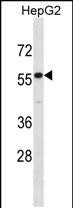 Rabbit Polyclonal Antibody to IL17RE(N-term)