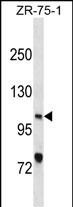 Rabbit Polyclonal Antibody to XPC(N-term)