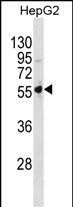 Rabbit Polyclonal Antibody to PSMD5(C-term)