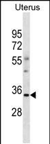 Rabbit Polyclonal Antibody to OR6S1(C-term)