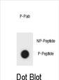 Rabbit Polyclonal Antibody to Phospho-KIT(S959)
