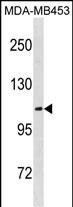 Rabbit Polyclonal Antibody to ENPP3(C-term)