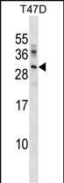 Rabbit Polyclonal Antibody to UBE2R2