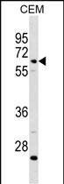 Rabbit Polyclonal Antibody to C8B