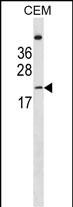 Rabbit Polyclonal Antibody to LIN7B (N-term)