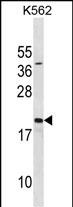 Rabbit Polyclonal Antibody to SUB1(Center)