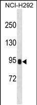 Rabbit Polyclonal Antibody to PRSS36(Center)