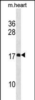 Rabbit Polyclonal Antibody to DAPL1(N-term)
