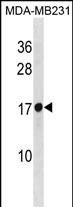 Rabbit Polyclonal Antibody to RPL30(N-term)