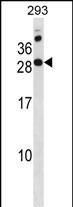 Rabbit Polyclonal Antibody to RAP2C(N-term)