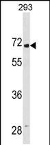 Rabbit Polyclonal Antibody to LINGO2(Center)