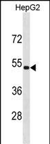 Rabbit Polyclonal Antibody to ZNF773(N-term)