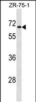 Rabbit Polyclonal Antibody to UGT2B28(Center)