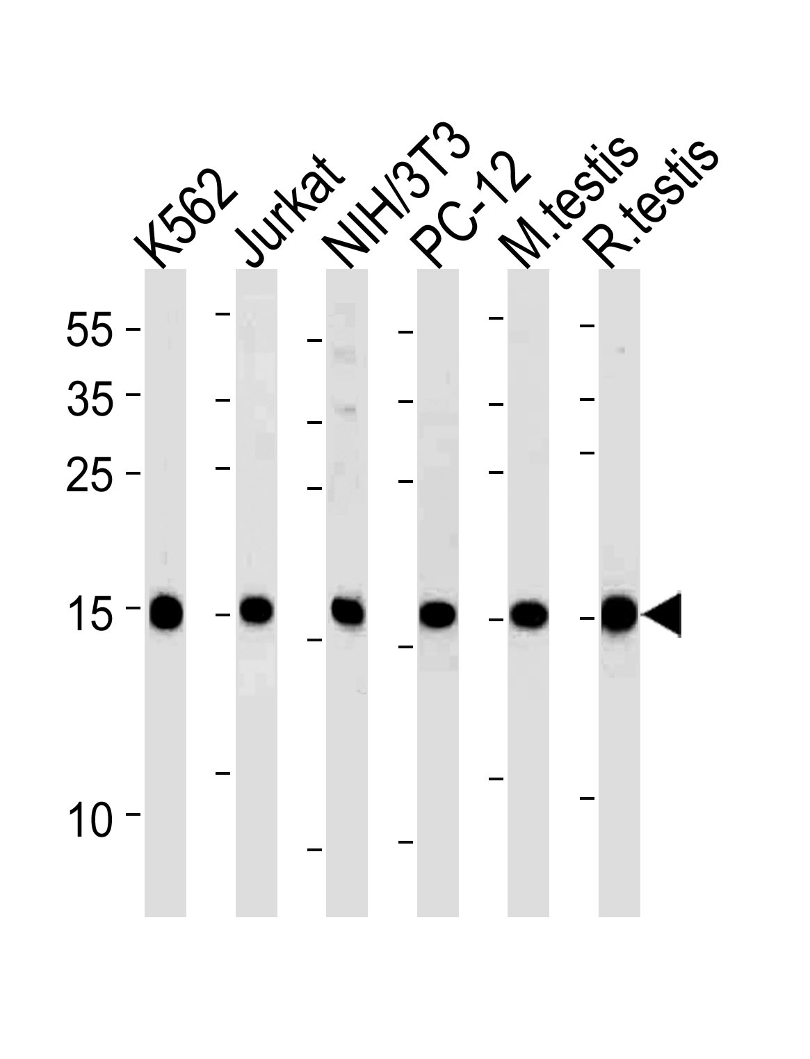 Rabbit Polyclonal Antibody to UBE2L3