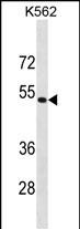Rabbit Polyclonal Antibody to PSMD4