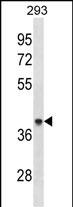 Rabbit Polyclonal Antibody to ACAA1